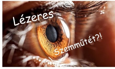 10 dolog, amit nem tudtál a lézeres szemműtétről